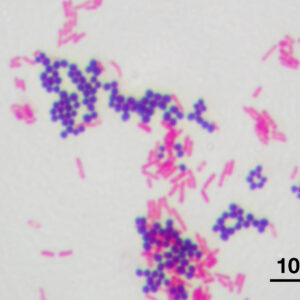 Gram Stain Set 4 Reagents Kit